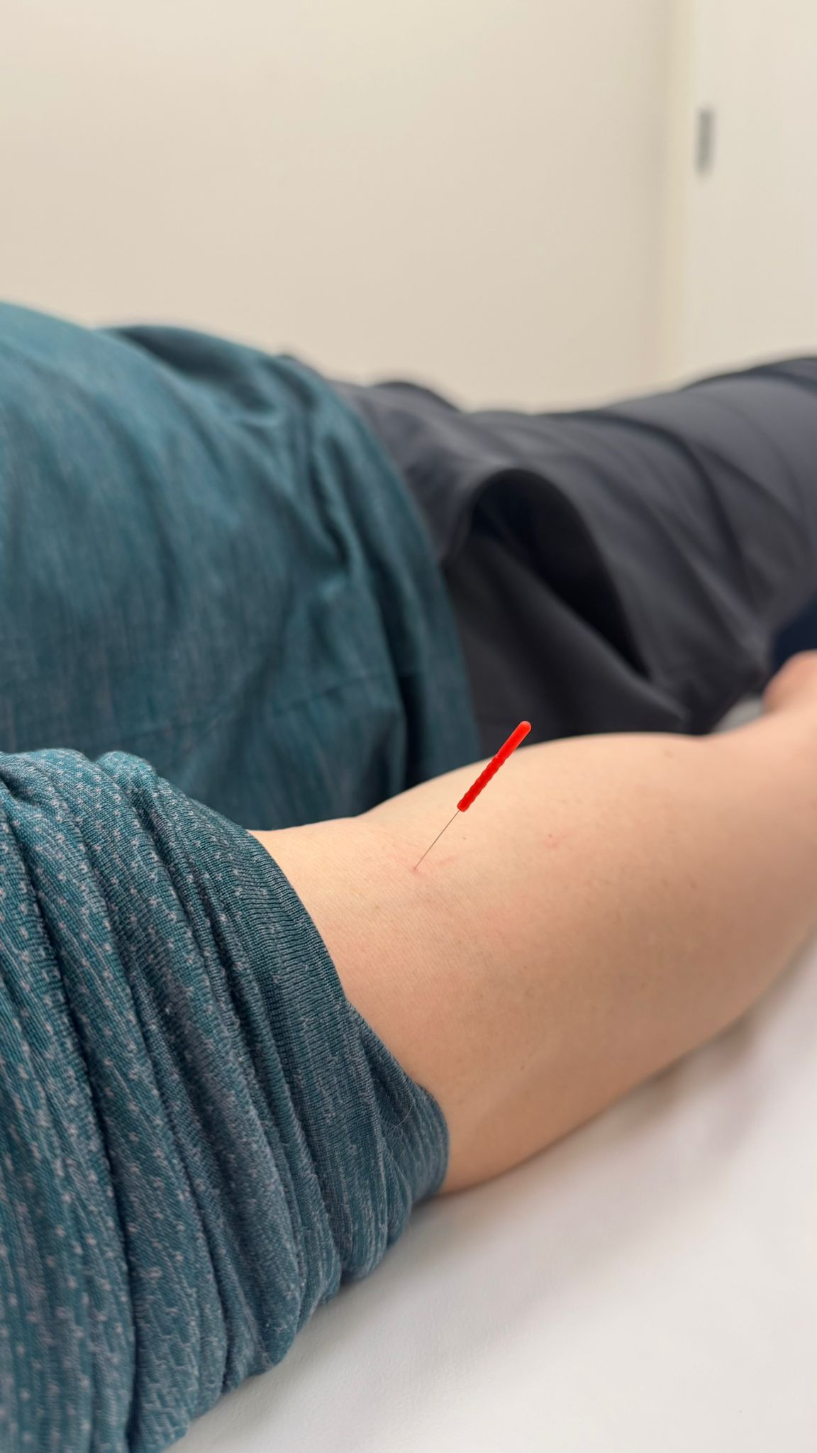 north york acupuncture